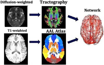 The impact of genetic risk for Alzheimer’s disease on the structural brain networks of young adults